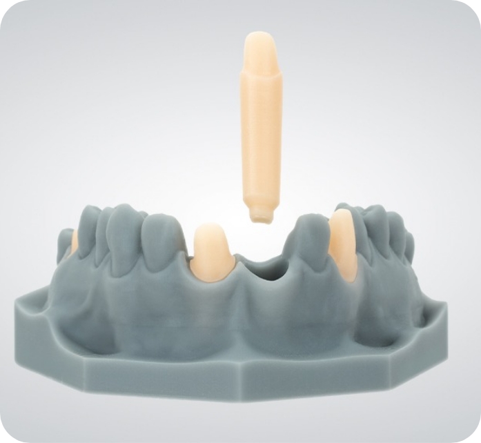 cad-cam-image-tooth